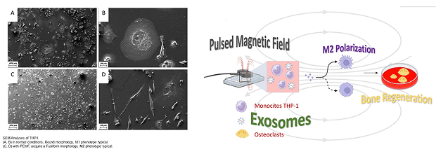 Bone Regeneration Revolution: Pulsed Electromagnetic Field Modulates Macrophage, Derived Exosomes to Attenuate Osteoclastogenesis