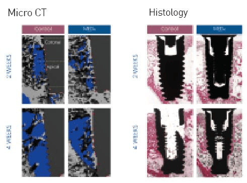 Solution for High-Risk Patients- A New Device for Improving Dental Implant Anchorage: A Histological and Micro-Computed Tomography Study in Rabbits