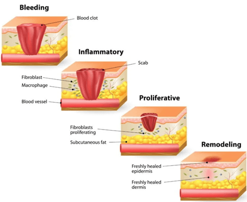 The Role of PEMF Therapy in Wound Healing and Tissue Regeneration