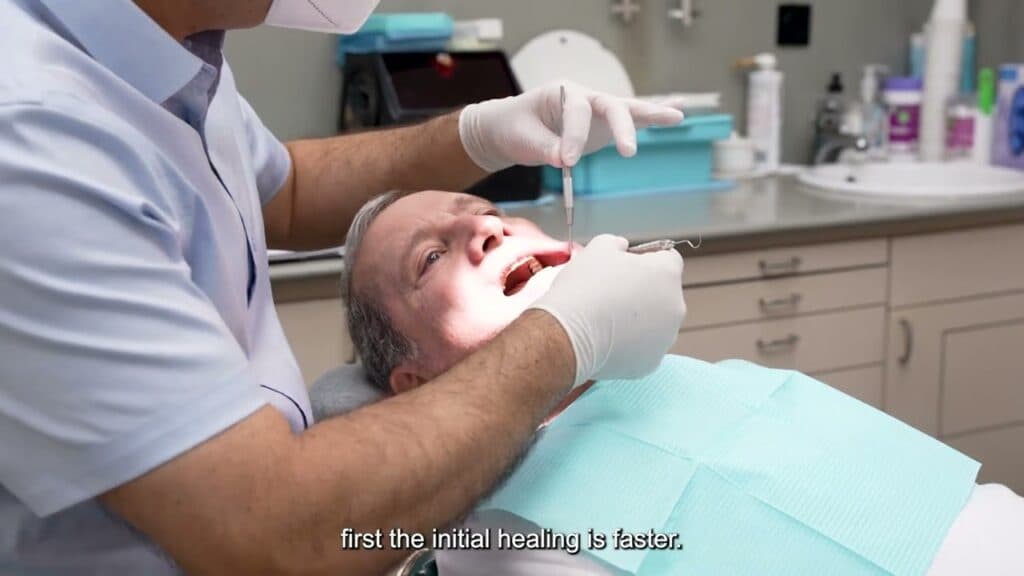 Combating Peri-Implantitis: A Comprehensive Overview and the Role of Magdent’s PEMF Technology