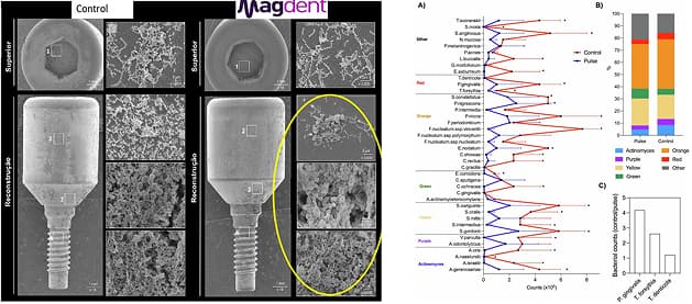 Microbiome Modulation of Implant-Related Infection by a Novel Miniaturized Pulsed Electromagnetic Field Device
